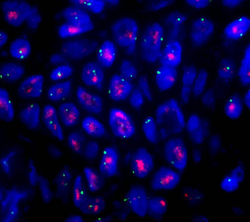 cytogenetic